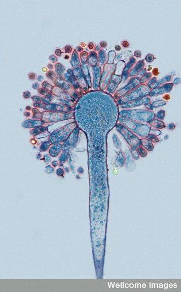 mycotoxines et équilibre hormonal
Image NIH